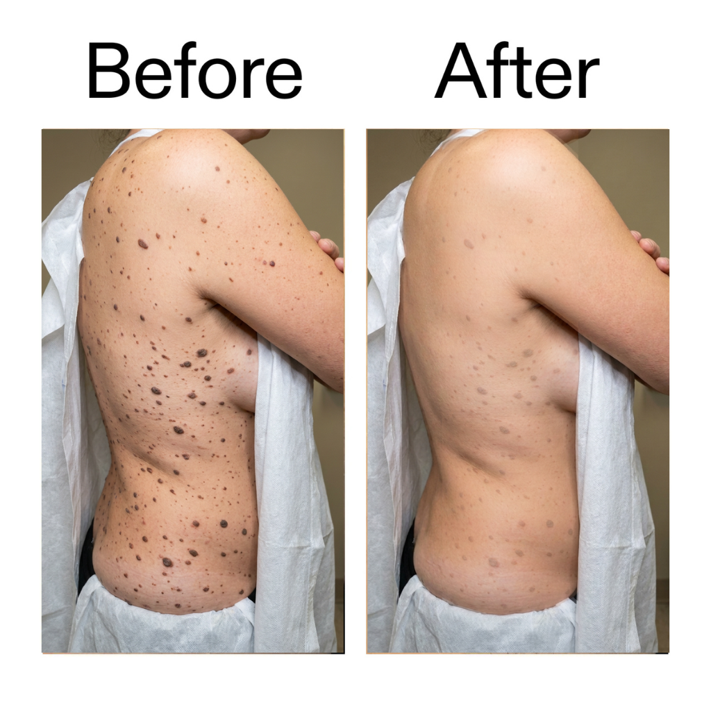 Daily Dissolve Body Stick